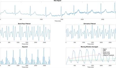 Multimodal automatic assessment of acute pain through facial videos and heart rate signals utilizing transformer-based architectures